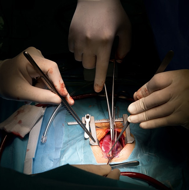 Gloved hands holding surgical tools performing surgery